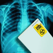 Cloison de protection contre les rayons X sans plomb | Safeboard