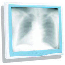 PC pour environnement médical | Onyx 1x3