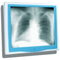 PC pour environnement médical | Onyx 1x3